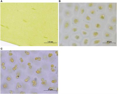 Two treatment methods on Ulva prolifera bloom result in distinctively different ecological effects in coastal environment